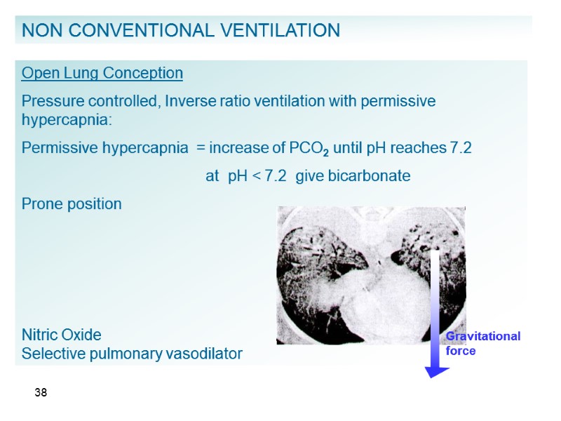 38 NON CONVENTIONAL VENTILATION Open Lung Conception Pressure controlled, Inverse ratio ventilation with permissive